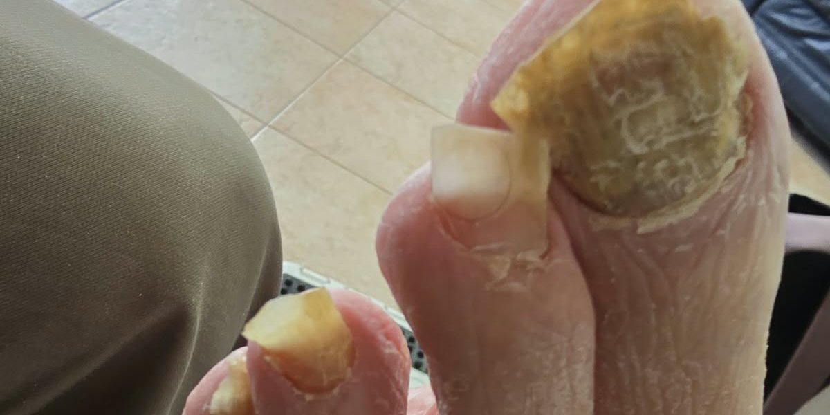 לפני הטיפול